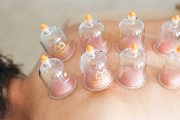 cupping
